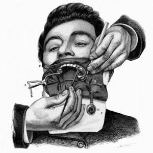 Diga di gomma del dottor Sanford Christie Barnum