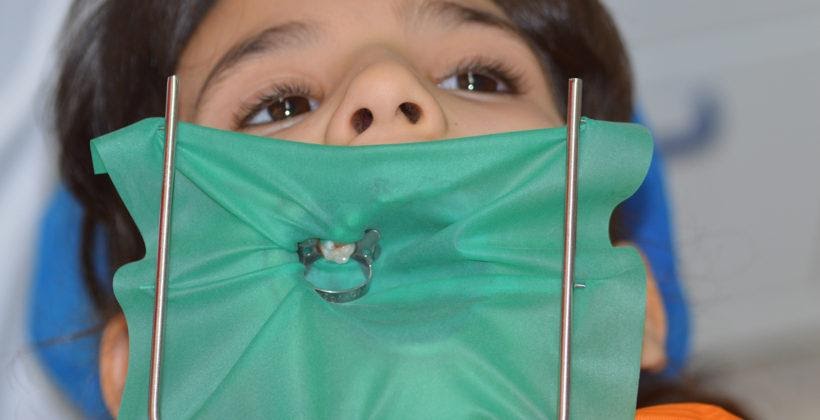 Cos'è la diga di gomma?