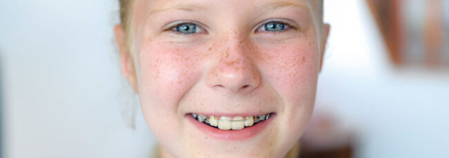 ortodonzia pediatrica