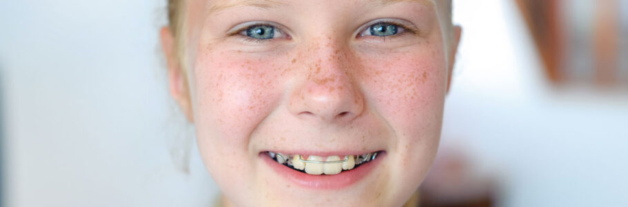 ortodonzia pediatrica