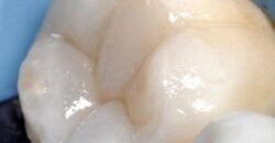 INGRANDIMENTI IN ODONTOIATRIA